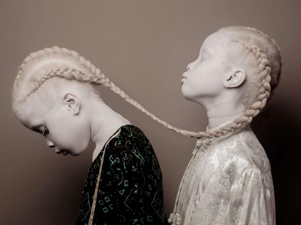 Albino7 présentation 3