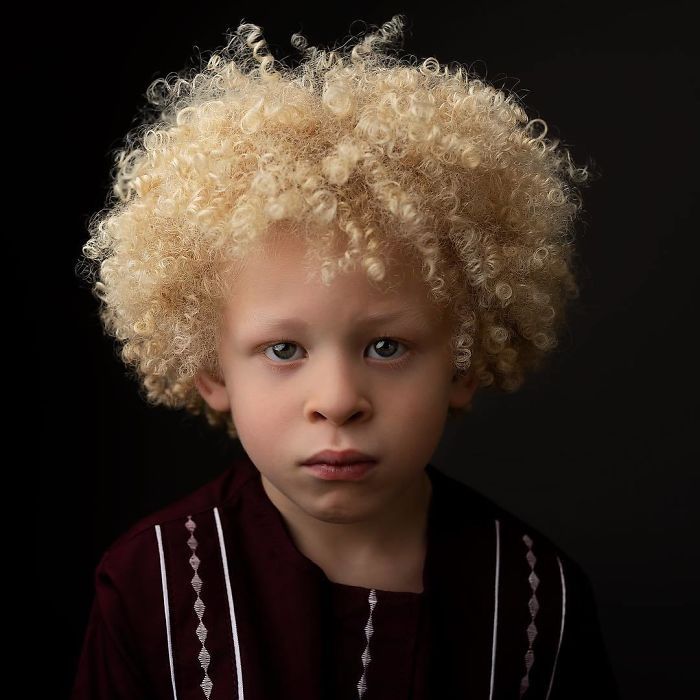 Albino7 présentation 1